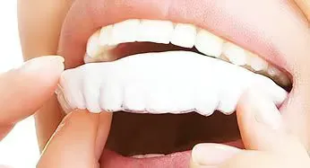 bleaching als alternative für weiße zähne