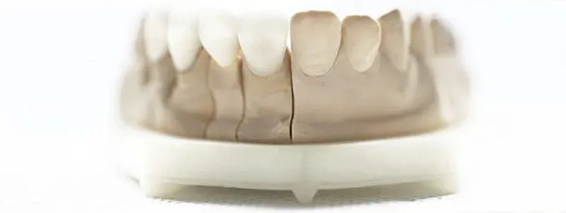 Zahnprothesen führen zu mehr Baktierien