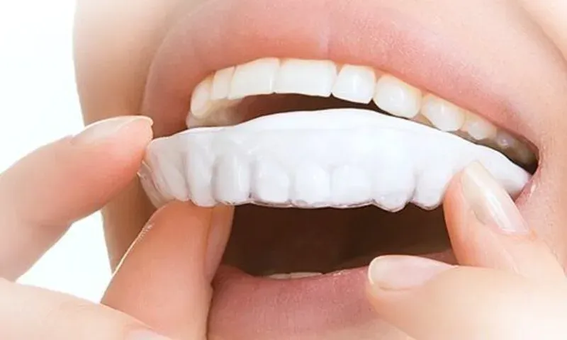 Weisheitszähne entfernen beim Zahnarzt